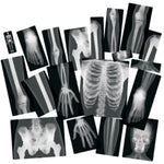 True to Life Human X-Rays